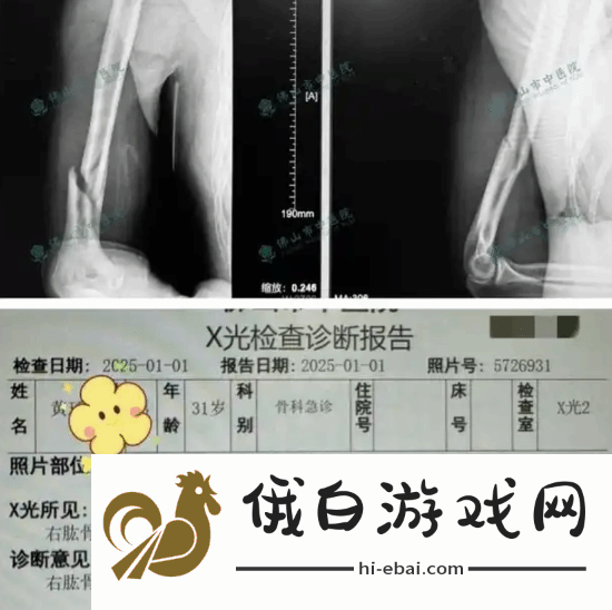 俩小伙挑战与机器人“掰手腕”