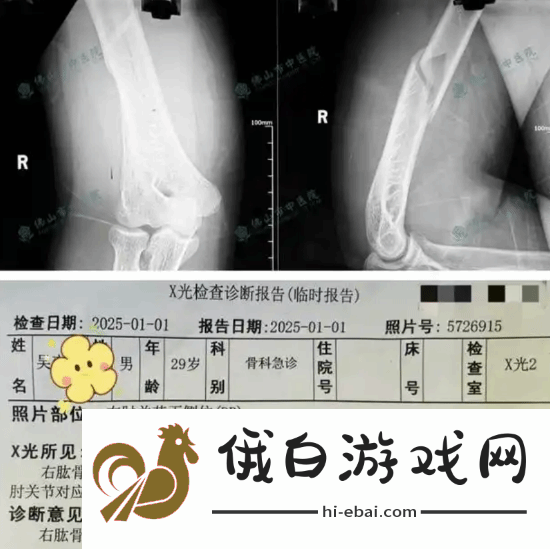 俩小伙挑战与机器人“掰手腕”