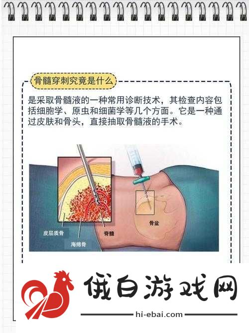 用注射器打水放**里相关站探秘